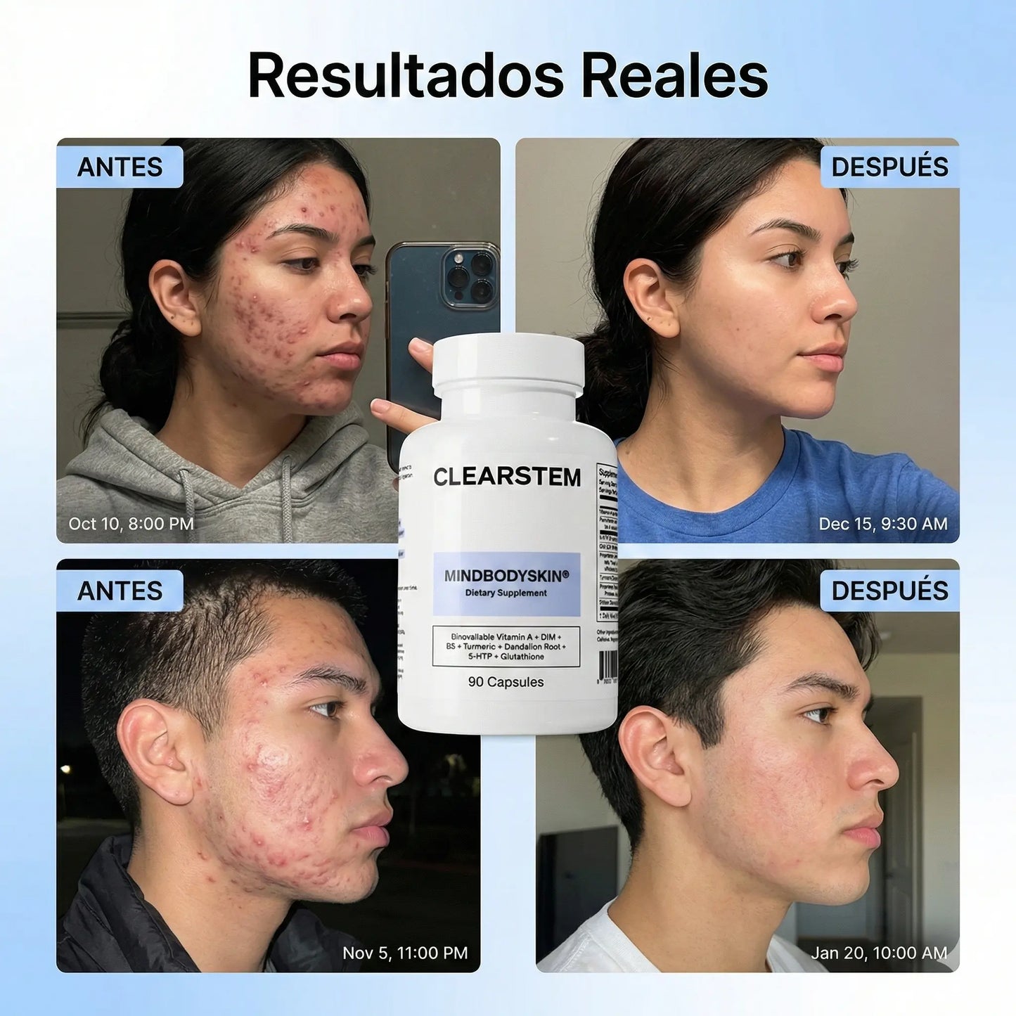 CLEARSTEM® – Fórmula Avanzada para Acné Hormonal y Piel Clara