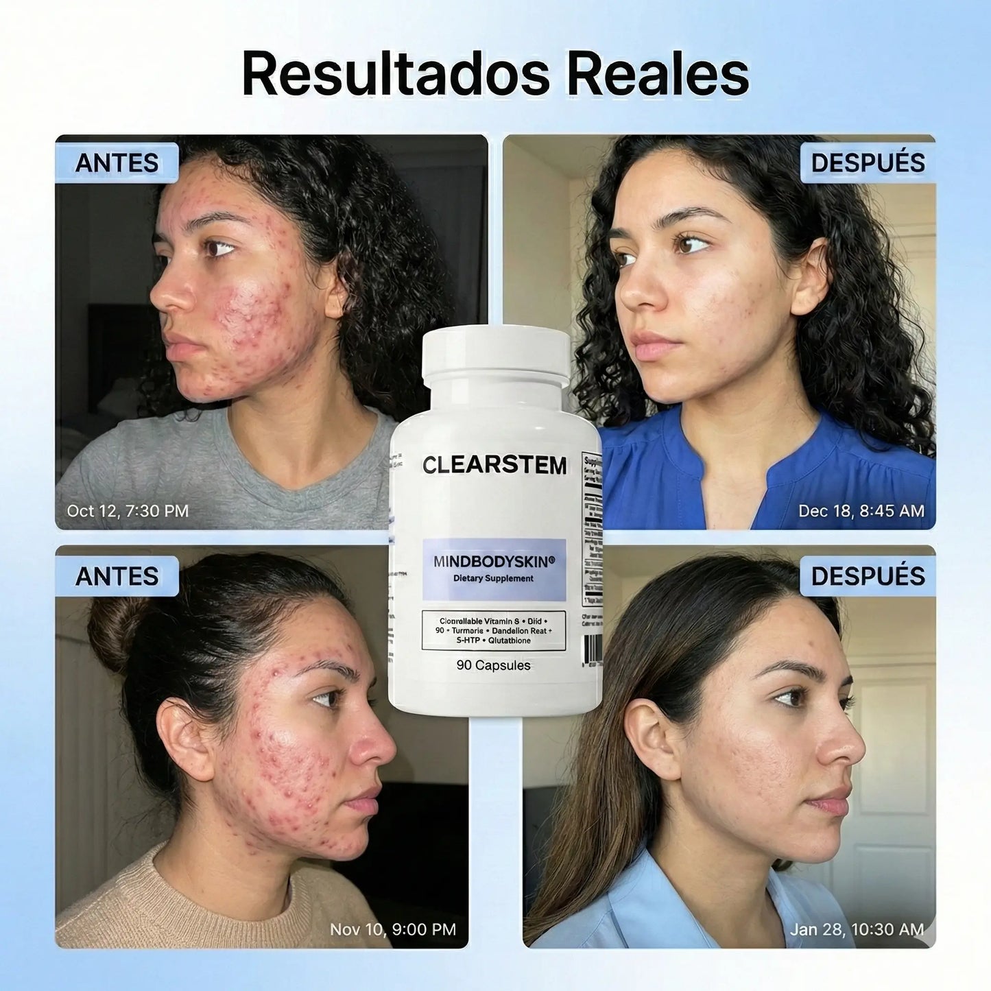 CLEARSTEM® – Fórmula Avanzada para Acné Hormonal y Piel Clara